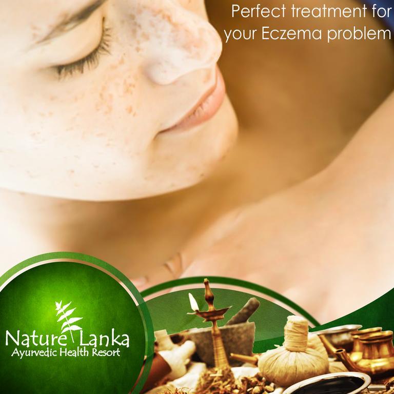 Nature Lanka Ayurveda Resort - All Meals And Ayurveda Treatments With Yoga Tangalle Exterior foto